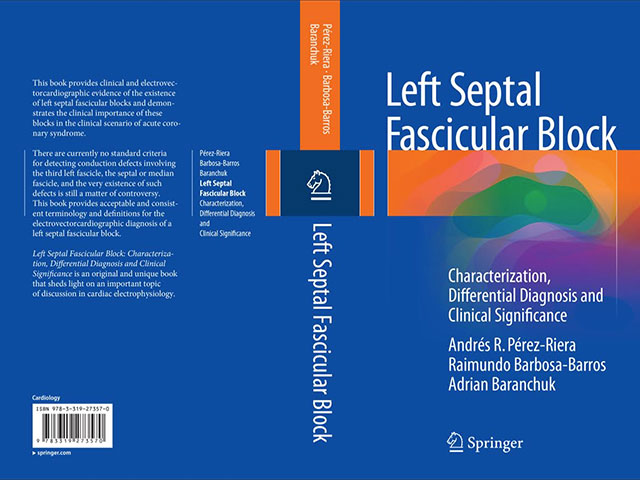 Left Septal Fascicular Block