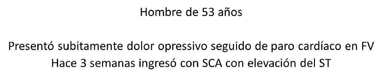 Paciente de 53 años que presenta FV intra-angor por espasmo coronario difuso