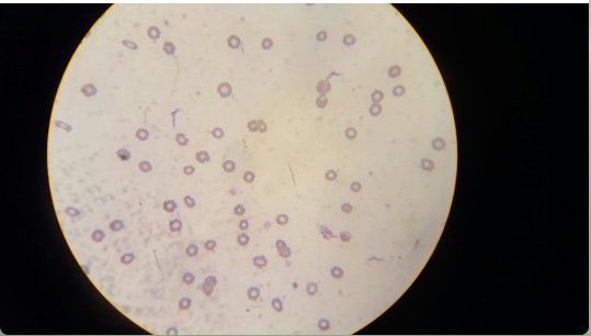 Chagas agudo en perro pitbull de 4 años