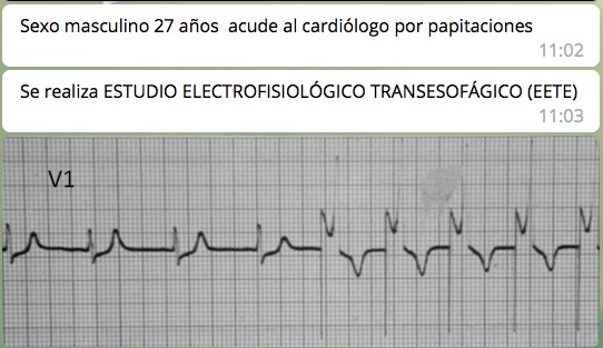 Paciente de 27 años con WPW