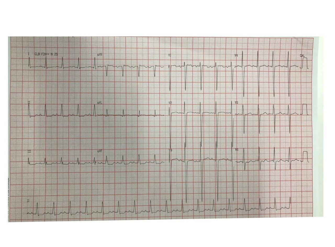 Paciente masculino de 19 años portador de CIV