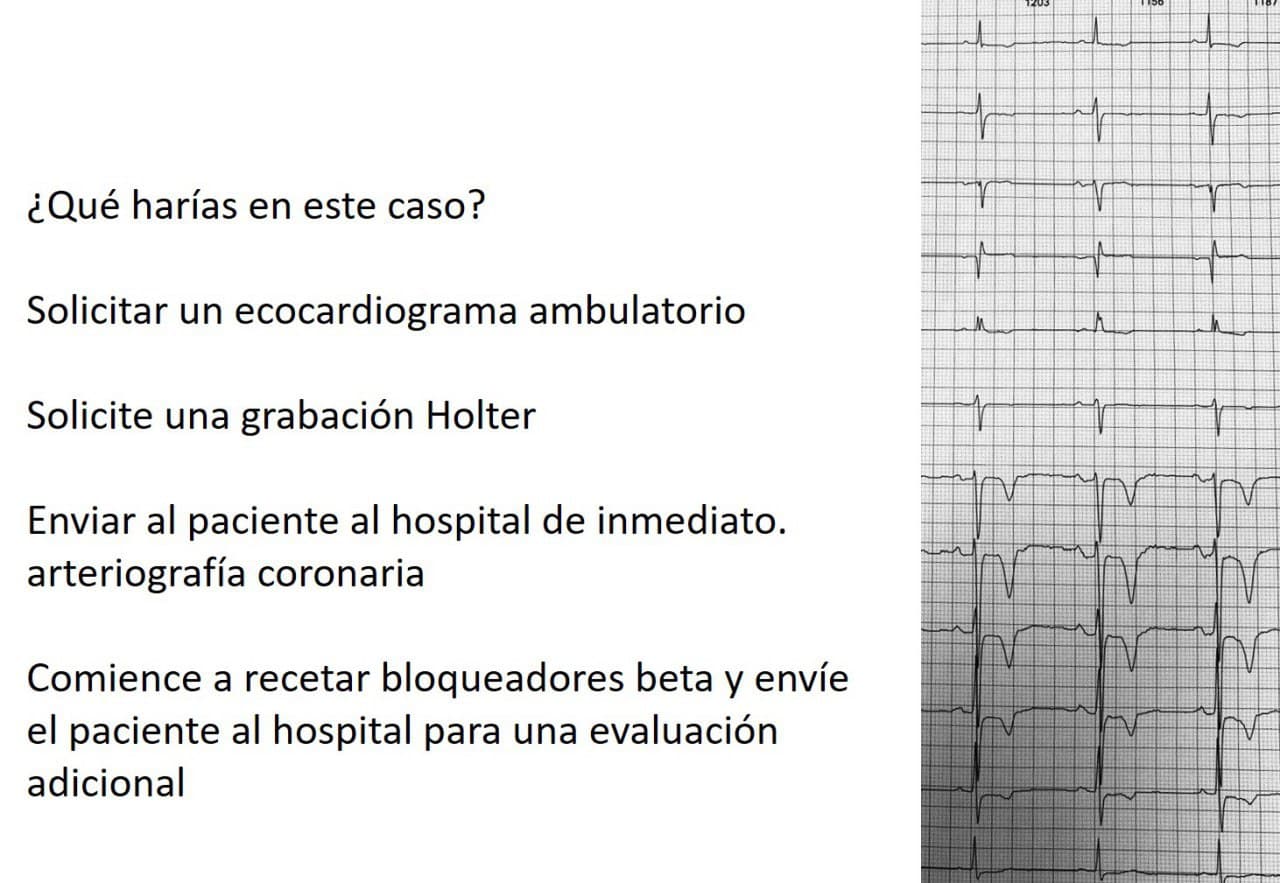 Hombre de 69 años, hipertenso asintomático cuyo ECG fue erróneamente interpretado como isquémico por presencia de T negativas que expresan memoria cardíaca