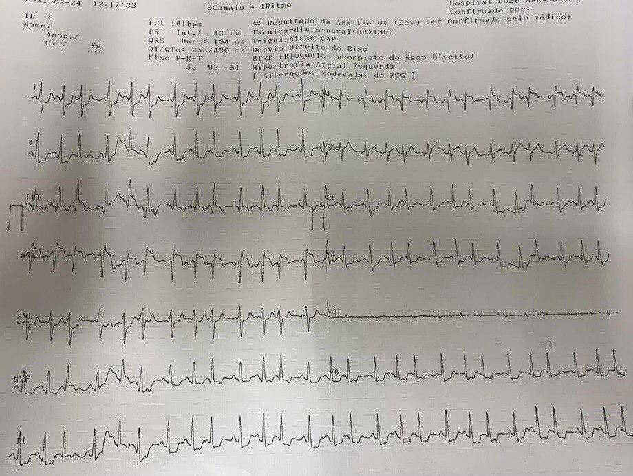 Varón de 41 años con antecedente de fiebre, tos, disnea desde hace 15 días con empeoramiento de la dificultad respiratoria, cursando COVID-19, con saturación del 78% por TEP